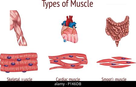 Vector illustration d'un types de muscles Illustration de Vecteur