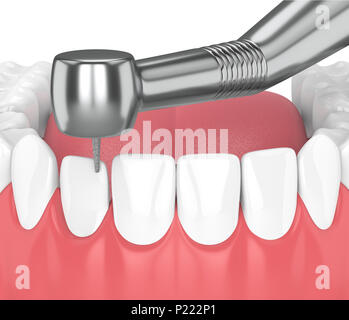 3D render of jaw avec pièce à main dentaire et percer isolated over white Banque D'Images