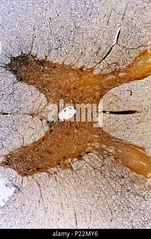 Neurone multipolaire du cordon médullaire. Les tissus nerveux 14x Banque D'Images