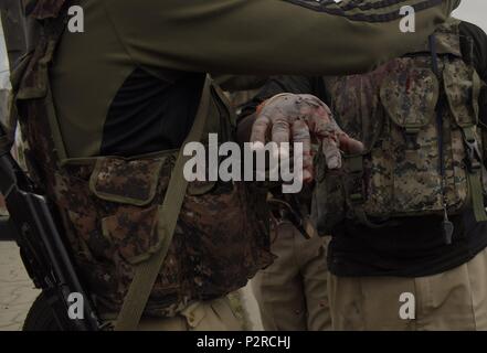 16 juin 2018 - Srinagar, au Cachemire, en Inde - UN CRPF(Centrales de Police Force) personne blessée après shell gaz lacrymogènes explosé dans sa propre main au cours d'affrontements avec les manifestants à l'occasion de Eid-ul-Fitr, à Eidgah de Srinagar, Indian-Administered-Cachemire le Samedi 16 Juin, 2018. Les musulmans du Cachemire se Eidgahs( la prière à la masse), des sanctuaires et des mosquées pour offrir des prières eid comme une grâce pour le jeûne d'un mois de Ramazan. Des affrontements ont également eu lieu à Srinagar ville Eidgah zone où une foule de fidèles se sont rassemblés pour offrir des prières Eid de la congrégation. (Crédit Image : © Sanna Banque D'Images