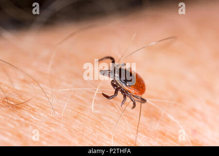 Une femelle, Ixodes ricinus, rampant sur un bras humain. Il a été trouvé dans une région où les cerfs et d'autres mammifères marins sont présents. Cette tique est également connu sous le nom de Banque D'Images