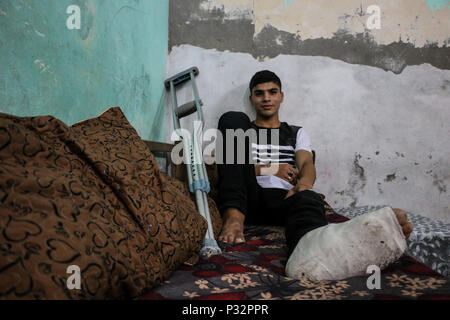 16 juin 2018 - hmed Jawad Mahmoud Othman a été tourné à sa gauche avec une balle de la vie par un tireur israélien le 14 mai lors de manifestations sur l'Gaza-Israeli frontière, à l'Est de l'al-Burej, camp de réfugiés contre le Président'Atout reconnaissance de Jérusalem comme capitale d'Israël et le transfert de l'ambassade des Etats-Unis de Tel Aviv à Jérusalem. 19 ans Ahmed Jawad vit dans l'Al- camp de réfugiés palestiniens de Bureij, dans le centre de la bande de Gaza. Le camp est très peuplée avec 34 951 habitants, 28 770 d'entre eux sont des réfugiés, et il n'a pas de système d'égout. La bande de Gaza hos Banque D'Images
