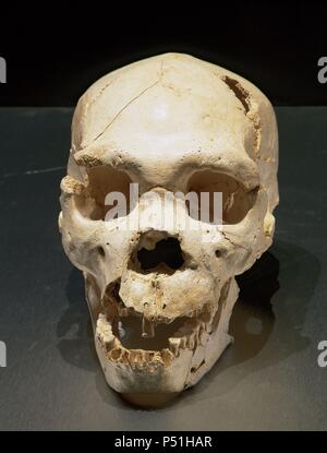 L'Homo heidelbergensis. Numéro 5 du crâne. Découverte dans la fosse des os de l'emplacement de Atapuerca (Espagne). Du Pléistocène moyen européen. Atapuerca. L'Espagne. Banque D'Images