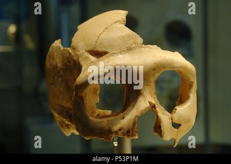 Crâne d'homme de Néanderthal (Homo neanderthalensis). Krapina. La Croatie. Musée d'histoire naturelle. Londres. United Kingdom. Banque D'Images