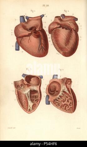 Sections du coeur. Gravure coloriée par Corbie d'un dessin par Leveille du Dr Joseph Nicolas Masse's 'Petit Atlas complet d'Anatomie descriptive du corps humain", Paris, 1864, publié par Mequignon-Marvis. Masse 'Pocket l'anatomie du corps humain' a été publié pour la première fois en 1848 et a connu plusieurs éditions. Banque D'Images