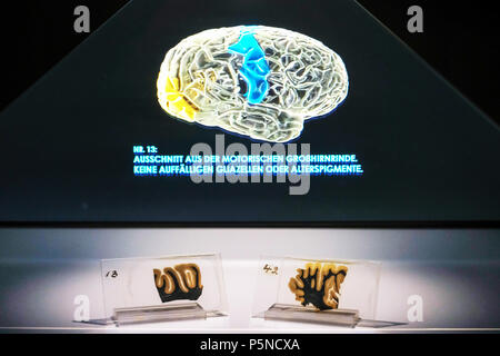 Deux sections histologiques du cerveau d'Albert Einstein (1879-1955) ci-dessous et d'un hologramme en trois dimensions de son cerveau illustré dans l'exposition 'Le cerveau - l'intelligence, Conscience, sentiment' dans la LWL Musée d'Histoire Naturelle, Münster, Allemagne, 2018 Jujy (prêteur : Mütter Museum, New York) Banque D'Images