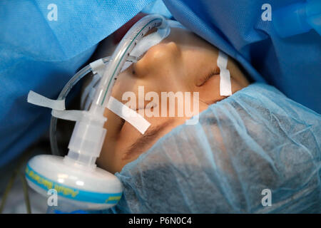 Tam Duc cardiologie Hôpital. Salle d'opération. La chirurgie cardiaque. L'anesthésie. Ho Chi Minh Ville. Le Vietnam. Banque D'Images
