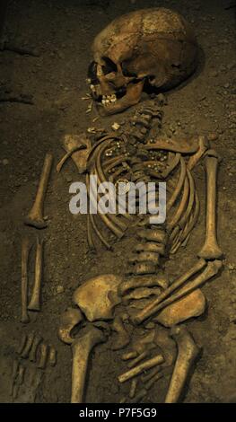 Âge des Vikings. Fille de Birka. Meurt à l'âge de 6 ans. 10e siècle. Squelette. Musée historique. Stockholm. La Suède. Banque D'Images