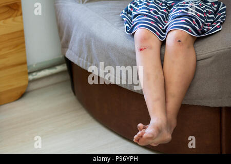 Portrait de jeune fille enfant pieds nus pieds avec les genoux meurtris blessés endommagé après une chute avec vieilles cicatrices et de sang frais. Traumatismes des enfants, accide Banque D'Images