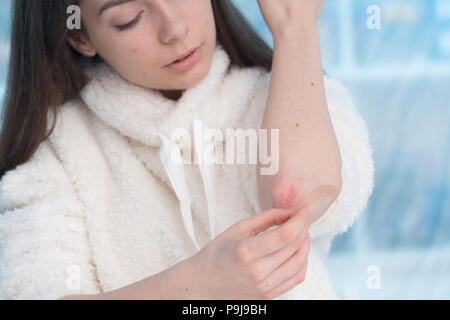 Femme à l'aide de ruban adhésif sur la main. Banque D'Images