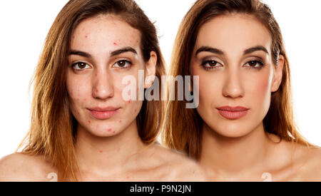 Portrait de femme comparition même avant et après le traitement cosmétique maquillage amd sur fond blanc Banque D'Images