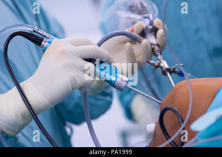 Munich, Allemagne. 19 juillet, 2018. Un médecin opérant sur un genou du patient dans le service de chirurgie orthopédique de l'OCM (Munich). Le patient a été équipé avec un ligament croisé de remplacement - qui a été préparé par l'un des tendons du patient lui-même - au cours de la chirurgie (arthroscopie). Crédit : Sven Hoppe/dpa/Alamy Live News Banque D'Images