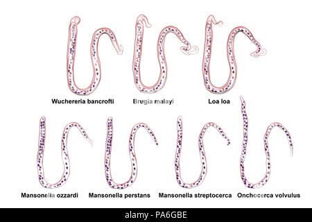La comparaison de la morphologie des microfilaires. Illustration d'ordinateur gainé et dégaina microfilaires worms aussi par différents noyaux queue emplacement. Banque D'Images