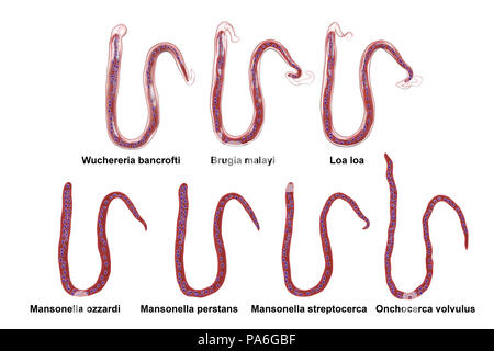 La comparaison de la morphologie des microfilaires. Illustration d'ordinateur gainé et dégaina microfilaires worms aussi par différents noyaux queue emplacement. Banque D'Images