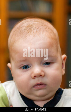 Vue De Face D Un Bebe Garcon Avec Un Ptosis De L Oeil Gauche Et Un Diagnostic Possible D Une Craniostenose Il A L Air Fatigue Son Etat Resolu Avant Photo Stock Alamy