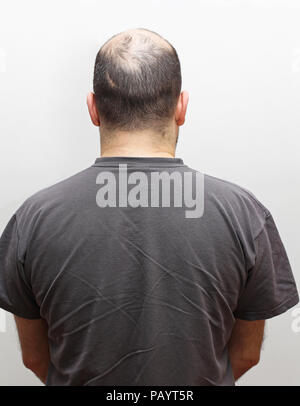 Vue arrière de la perte de cheveux à l'homme d'âge moyen Banque D'Images