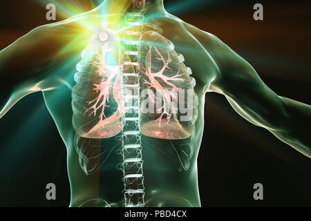 Traitement et prévention de la tuberculose, l'illustration conceptuelle. Banque D'Images