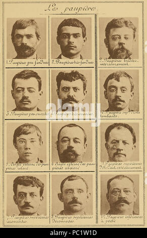 14 Bertillon - Identification anthropométrique (1893) 313 Banque D'Images