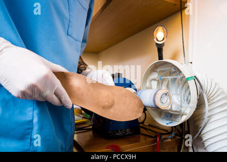 Le processus de fabrication des semelles orthopédiques pour les personnes atteintes de maladies de la jambe, les pieds plats. Close-up de la main d'un homme d'un employé demande instamment une o Banque D'Images