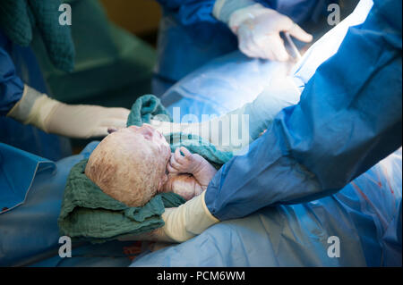 Une femme donnant naissance à des jumeaux par césarienne (Heverlee, 30/12/2016) Banque D'Images