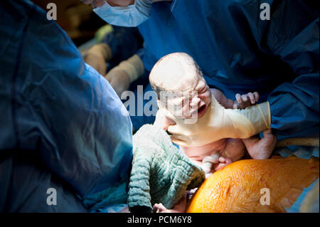 Une femme donnant naissance à des jumeaux par césarienne (Heverlee, 30/12/2016) Banque D'Images