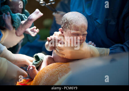 Une femme donnant naissance à des jumeaux par césarienne (Heverlee, 30/12/2016) Banque D'Images