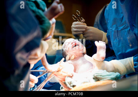 Une femme donnant naissance à des jumeaux par césarienne (Heverlee, 30/12/2016) Banque D'Images