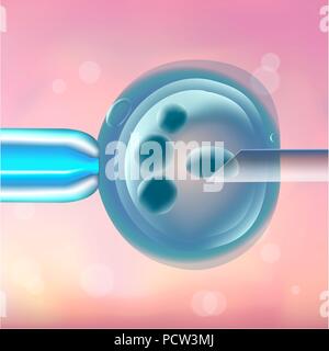 Sélection d'oeufs pour la fertilisation in vitro (FIV), l'illustration. Les ovocytes dépose à l'ovaire d'une femme. Banque D'Images