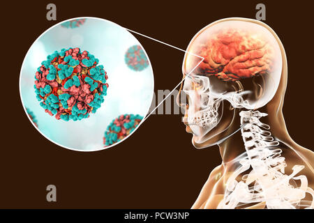 L'encéphalite équine vénézuélienne virus infectant cerveau humain, illustration de l'ordinateur. Ce virus transmis par les moustiques peuvent engendrer la mort de l'inflammation du cerveau et de la moelle épinière chez les chevaux. Il peut également causer une fièvre mortelle chez les humains. Dans les virus, la capside est la protéine qui enferme les shell le matériel génétique. La capside est constituée de sous-unités d'un capsomeres appelé qui s'auto-assemblent pour former la coquille vu ici. L'une des fonctions de la capside est de faciliter la transmission de le matériel génétique du virus dans les cellules de l'hôte. Banque D'Images