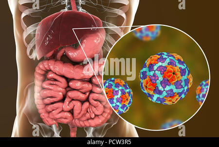 L'hépatite A L'infection. Illustration de l'ordinateur et du foie vue rapprochée de l'hépatite A virus. Banque D'Images