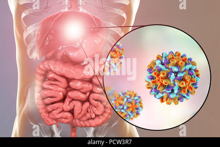 L'HÉPATITE B L'infection. Illustration de l'ordinateur et du foie close-up view of hepatitis B virus. Banque D'Images