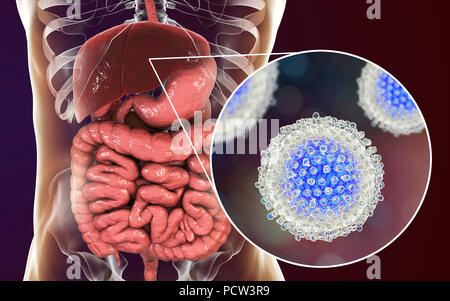 L'infection par l'hépatite C. Illustration de l'ordinateur et du foie vue rapprochée de l'hépatite C les virus. Banque D'Images