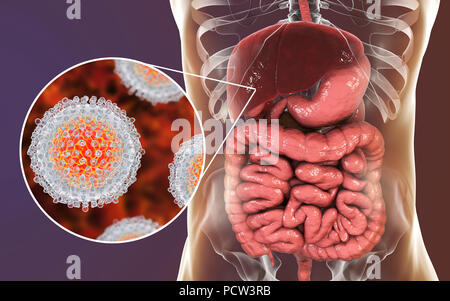 L'infection par l'hépatite C. Illustration de l'ordinateur et du foie vue rapprochée de l'hépatite C les virus. Banque D'Images