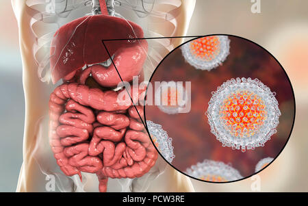 L'infection par l'hépatite C. Illustration de l'ordinateur et du foie vue rapprochée de l'hépatite C les virus. Banque D'Images