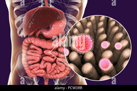 Les rotavirus infectant l'intestin, l'illustration de l'ordinateur. La particule virale est constituée d'un ARN (acide ribonucléique) noyau entouré d'une triple capside en couches. Les rotavirus sont probablement le plus commun des virus pour infecter les humains et les animaux. Ils sont associés à la gastro-entérite et la diarrhée - généralement d'infecter les intestins des enfants âgés de 6 mois à 3 ans. Les virus se propagent dans les fèces. Banque D'Images