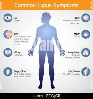 Les symptômes du lupus commun icône logo vector illustration Illustration de Vecteur