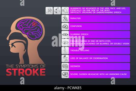 Les symptômes de l'avc Design infographique, icône de la santé, de l'infographie médicale. Vector illustration Illustration de Vecteur