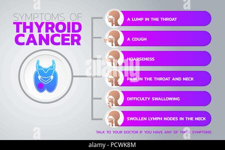 Facteurs de risque de cancer de la thyroïde conception infographique, icône de la santé, de l'infographie médicale. Vector illustration Illustration de Vecteur