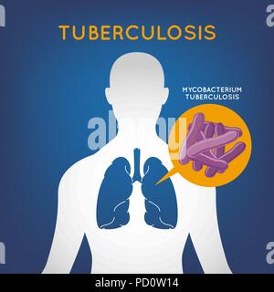 La tuberculose l'icône logo vector illustration Illustration de Vecteur