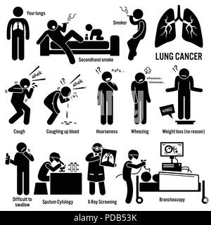 Le cancer du poumon Symptômes Causes Facteurs de risque Diagnostic Stick Figure Icônes pictogramme Illustration de Vecteur