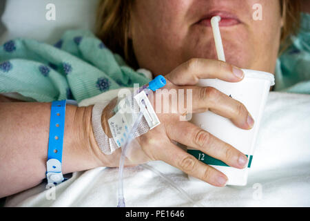 Miami Florida,Université de Miami,Doctor's Hospital,soins de santé,femme femme femme,main,mains,ID,intraveineuse,IV,ligne,tubes,aiguilles,soins de santé,goutte,infu Banque D'Images