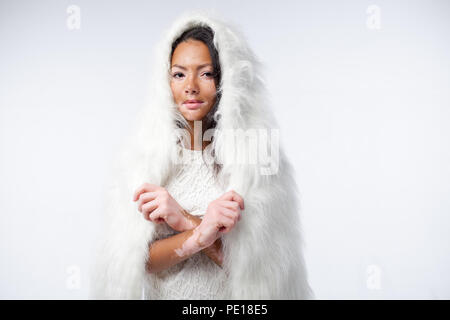 Une belle fille africaine avec des problèmes de peau est habillé en fausse fourrure blanche et chaude. Concept de vitiligo. Banque D'Images