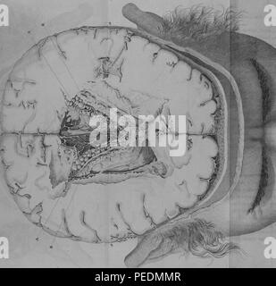 Noir et blanc illustrant un échantillon représentatif des ventricules latéraux d'un cerveau humain, avec des chiffres indiquant l'ordre alphabétique des sites d'infestations de ver ventriculaire, 1825. Avec la permission de Internet Archive. () Banque D'Images