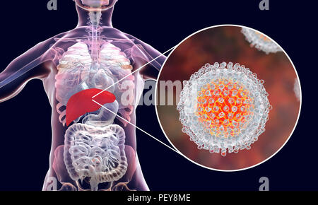 L'infection par l'hépatite C. Illustration d'ordinateur montrant le foie et une vue rapprochée de l'hépatite C les virus. Banque D'Images