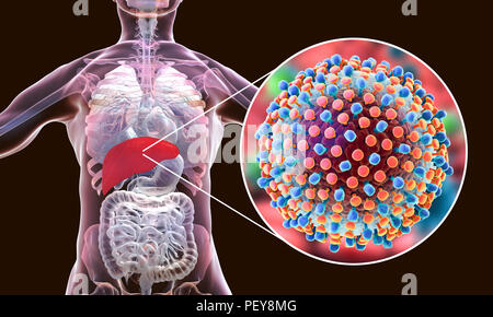 L'infection par l'hépatite C. Illustration d'ordinateur montrant le foie et une vue rapprochée de l'hépatite C les virus. Banque D'Images