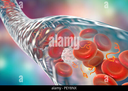 Les particules du virus Ebola dans le sang, l'illustration de l'ordinateur. Ce virus est la cause du virus Ebola chez les humains et les primates. Il s'agit d'une forme grave et souvent mortelle, avec des symptômes comme de la fièvre, de la fatigue, des douleurs musculaires, des vomissements, de la diarrhée et des hémorragies (hémorragie interne). Il n'y a pas de remède pour la maladie, mais les trois quarts des patients peuvent se rétablir si suffisamment de soutien médical. Banque D'Images