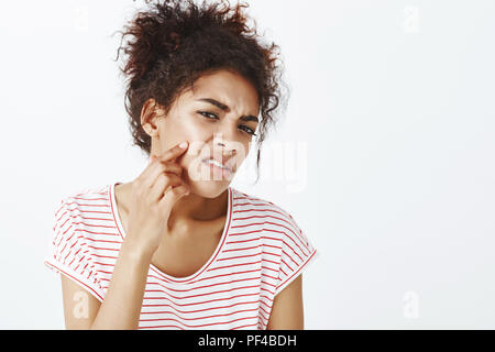 Déplut à peau sombre malheureuse femme avec les cheveux peignés, fronçant et pointant à l'acné sur la joue, d'être contrarié par de nouveaux boutons et mauvais état, debout face au mur gris déçu Banque D'Images