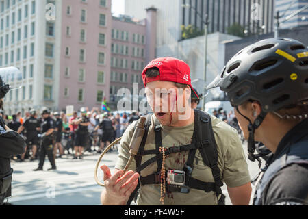 Seattle, WA, USA. 18 août, 2018. Un pistolet pro supporter soit blessée par un objet inconnu où des armes à feu et des armes à feu pro anti partisans face à l'arrêt. Crédit : Maria S./Alamy Live News. Banque D'Images