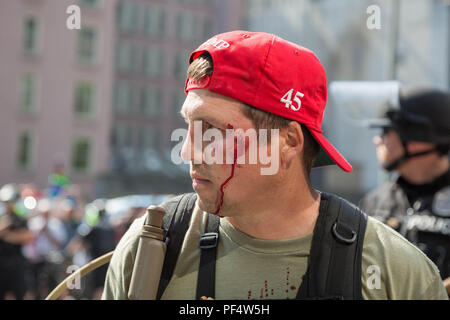 Seattle, WA, USA. 18 août, 2018. Un pistolet pro supporter soit blessée par un objet inconnu où des armes à feu et des armes à feu pro anti partisans face à l'arrêt. Crédit : Maria S.Alamy Live News. Banque D'Images
