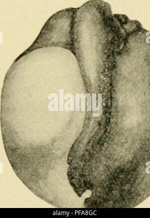 . Le développement de l'œuf de grenouille ; une introduction à l'embryologie expérimentale. L'embryologie. Ch. XI] EFFET D'UNE IXJURIXG 107 BLASTOMÈRES aiguille chaude. L'aiguille est aiguisé avec soin, et est re- aiguisée après chaque oeuf est opérée. Il est préférable de percer le blastomère dans l'hémisphère noir près du premier-plan de clivage. L'aiguille passe à travers sur la moitié (ou plus) de l'blastomère. Lorsque l'aiguille est retirée, une plus ou moins de quantité du contenu du pro- trudes blastomères où le blastomère a été blessé. L'oeuf après opération est remis à l'eau. Il est necessa Banque D'Images
